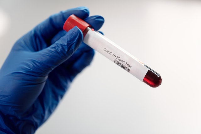 De antigeentest vs. de PCR-test: Wat is het verschil?